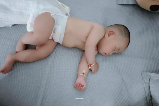 江阴宝宝头上长痱子 江阴宝宝头上长痱子